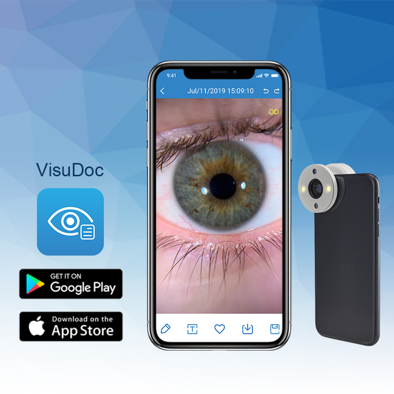 Smartphone Eye Imaging Adaptor, app